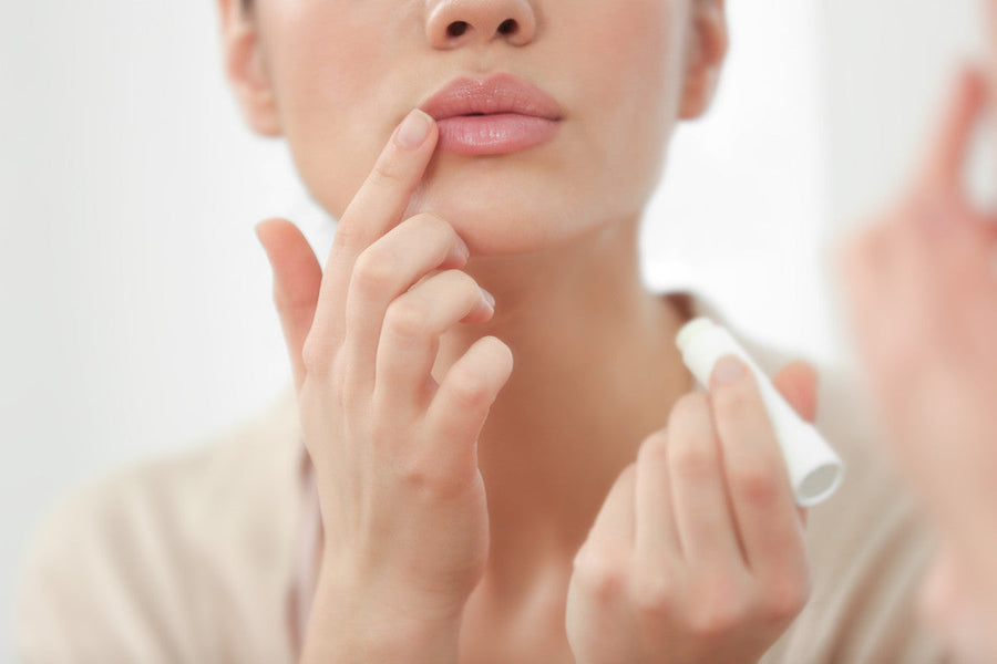 Preventing Cracked, Dry Lips This Winter: My Best Tips