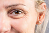 close-up of woman's eye with under-eye bags